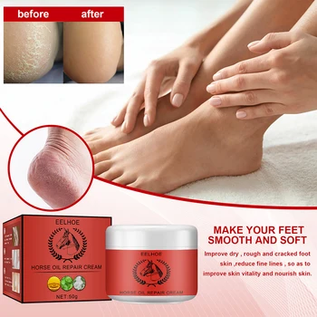 Anti-Sušenie Hydratačný Krém na Nohy Krém na Pokožke Úľavu Intenzívnej Vlhkosti Nohy Anti-Sušenie Krém EIG88